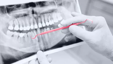 Trained Machine Learning Algorithm Development For Teeth Detection