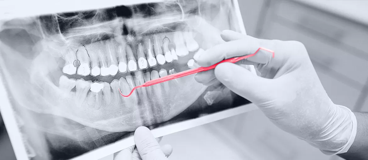 Trained Machine Learning Algorithm Development For Teeth Detection